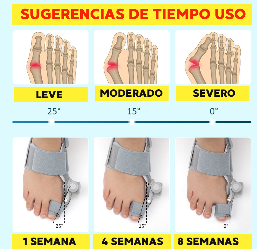 CORRECTOR DE JUANETES AJUSTABLE 180°| ALIVIA EL DOLOR