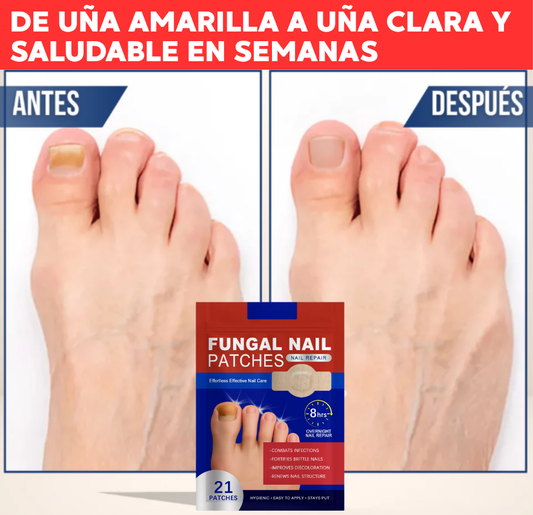 PARCHES ELIMINA HONGOS EN UÑAS 🦶 | PACK 21 PARCHES