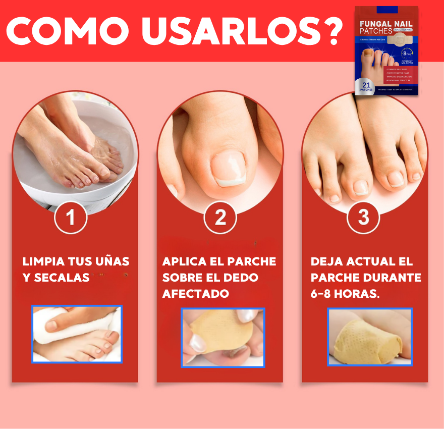 PARCHES ELIMINA HONGOS EN UÑAS 🦶 | PACK 21 PARCHES