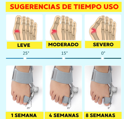 CORRECTOR DE JUANETES AJUSTABLE 180°| ALIVIA EL DOLOR