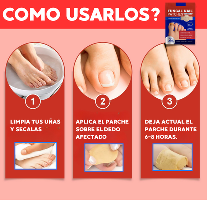 PARCHES ELIMINA HONGOS EN UÑAS 🦶 | PACK 21 PARCHES